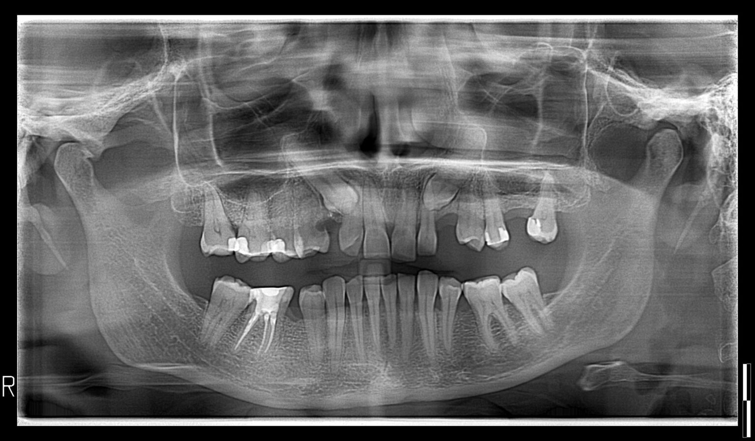 001Nv2-2021-2-1536x897