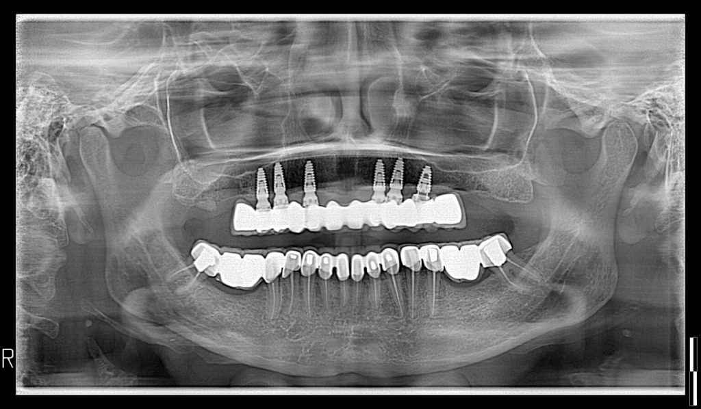 002Nv2-2021-2-1536x897